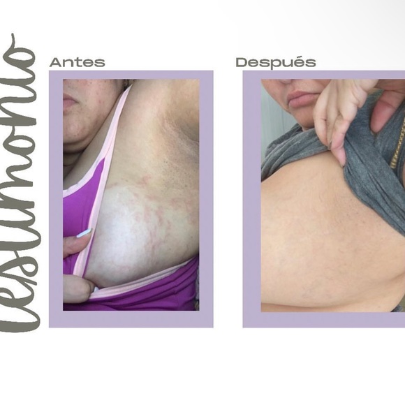 Meet your Posher, MB Distributor, LLC - Picture 3 of 17